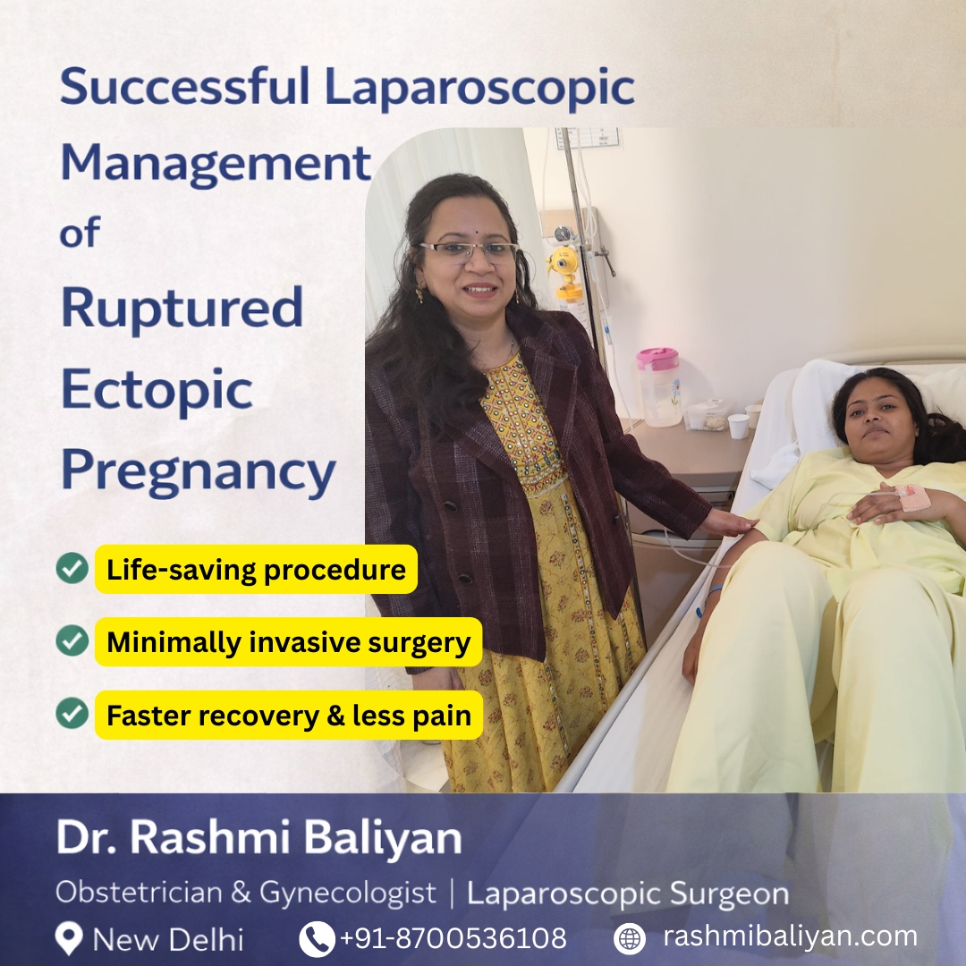 Successful Laparoscopic Management of Ruptured Ectopic Pregnancy