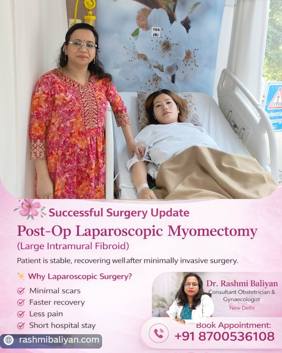 Laparoscopic Myomectomy for Intramural Fibroid | Expert Care in Delhi